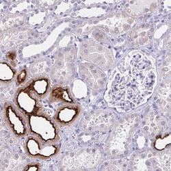 Invitrogen SLC12A3 Polyclonal Antibody 100 &mu;L; Unconjugated:Antibodies,