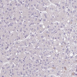 Invitrogen SLC12A3 Polyclonal Antibody 100 &mu;L; Unconjugated:Antibodies,