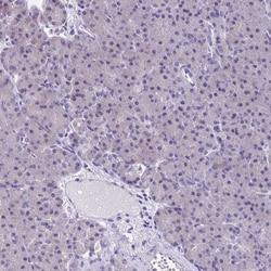 Invitrogen SLC12A3 Polyclonal Antibody 100 &mu;L; Unconjugated:Antibodies,