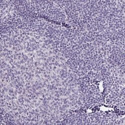 Invitrogen SLC12A3 Polyclonal Antibody 100 &mu;L; Unconjugated:Antibodies,