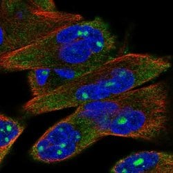 Invitrogen P2X6 Polyclonal Antibody 100 &mu;L; Unconjugated:Antibodies,