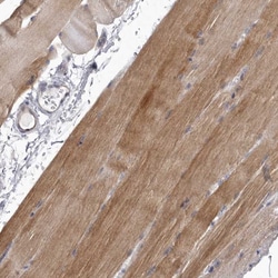 Invitrogen P2X6 Polyclonal Antibody 100 &mu;L; Unconjugated:Antibodies,