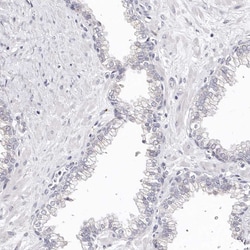Invitrogen CDCA8 Polyclonal Antibody 100 &mu;L; Unconjugated:Antikörper