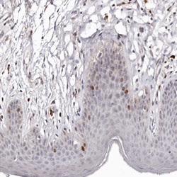 Invitrogen™ CDCA8 Polyclonal Antibody