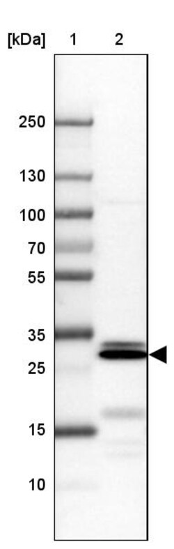 Invitrogen CDCA8 Polyclonal Antibody 100 &mu;L; Unconjugated:Antikörper