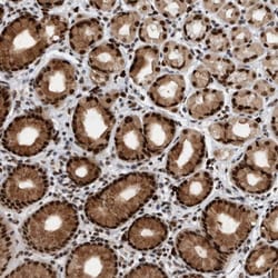 Invitrogen ZNF260 Polyclonal Antibody 100 &mu;L; Unconjugated:Antibodies,