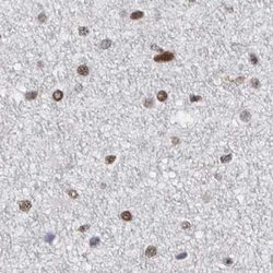 Invitrogen SFRS15 Polyclonal Antibody 100 &mu;L; Unconjugated:Antibodies,