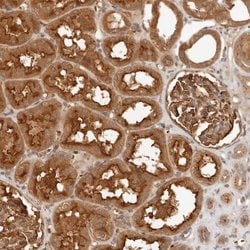 FREM2 Polyclonal Antibody, Invitrogen 100 &mu;L | Buy Online | Thermo Scientific | Fisher Scientific