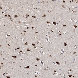 Invitrogen SLC10A4 Polyclonal Antibody 100 &mu;L; Unconjugated:Antibodies,