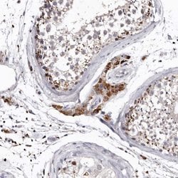 Invitrogen SLC10A4 Polyclonal Antibody 100 &mu;L; Unconjugated:Antibodies,
