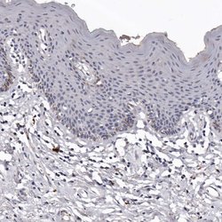 Invitrogen SLC10A4 Polyclonal Antibody 100 &mu;L; Unconjugated:Antibodies,