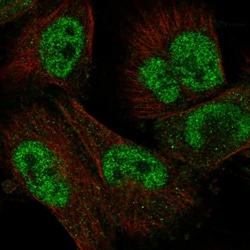 Invitrogen UBOX5 Polyclonal Antibody 100 &mu;L; Unconjugated:Antibodies,