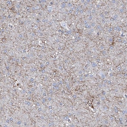 Invitrogen UBOX5 Polyclonal Antibody 100 &mu;L; Unconjugated:Antibodies,