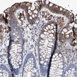 Invitrogen UBOX5 Polyclonal Antibody 100 &mu;L; Unconjugated:Antibodies,