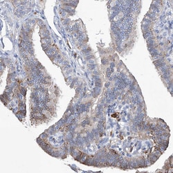 Invitrogen UBOX5 Polyclonal Antibody 100 &mu;L; Unconjugated:Antibodies,