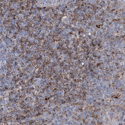 Invitrogen UBOX5 Polyclonal Antibody 100 &mu;L; Unconjugated:Antibodies,