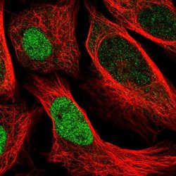 Invitrogen UBE2E2 Polyclonal Antibody 100 &mu;L; Unconjugated:Antibodies,