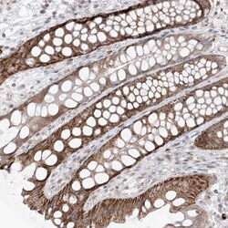 Invitrogen UBE2E2 Polyclonal Antibody 100 &mu;L; Unconjugated:Antibodies,