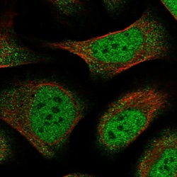 Invitrogen ZFP28 Polyclonal Antibody 100 &mu;L; Unconjugated:Antibodies,