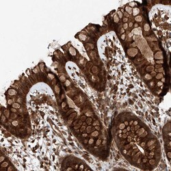 Invitrogen ZFP28 Polyclonal Antibody 100 &mu;L; Unconjugated:Antibodies,
