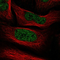 Invitrogen PHF5A Polyclonal Antibody 100 &mu;L; Unconjugated:Antibodies,