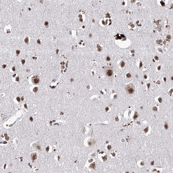 Invitrogen PHF5A Polyclonal Antibody 100 &mu;L; Unconjugated:Antibodies,