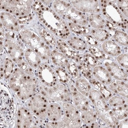 Invitrogen PHF5A Polyclonal Antibody 100 &mu;L; Unconjugated:Antibodies,