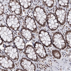 Invitrogen PHF5A Polyclonal Antibody 100 &mu;L; Unconjugated:Antibodies,