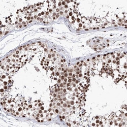 Invitrogen PHF5A Polyclonal Antibody 100 &mu;L; Unconjugated:Antibodies,