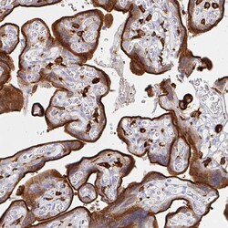 Invitrogen DAB2 Polyclonal Antibody 100 &mu;L; Unconjugated:Antibodies,