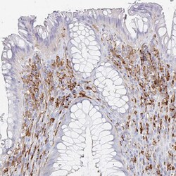 Invitrogen DAB2 Polyclonal Antibody 100 &mu;L; Unconjugated:Antibodies,