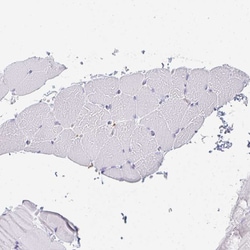 Invitrogen DAB2 Polyclonal Antibody 100 &mu;L; Unconjugated:Antibodies,