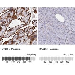 Invitrogen DAB2 Polyclonal Antibody 100 &mu;L; Unconjugated:Antibodies,