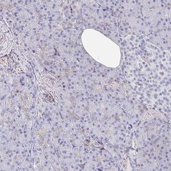 Invitrogen DAB2 Polyclonal Antibody 100 &mu;L; Unconjugated:Antibodies,