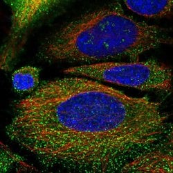 Invitrogen DAB2 Polyclonal Antibody 100 &mu;L; Unconjugated:Antibodies,