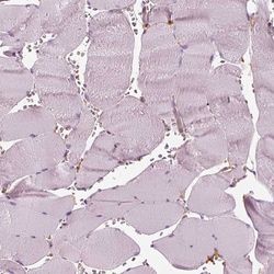 Invitrogen RNF36 Polyclonal Antibody 100 &mu;L; Unconjugated:Antibodies,