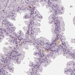 Invitrogen RNF36 Polyclonal Antibody 100 &mu;L; Unconjugated:Antibodies,