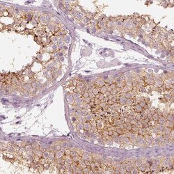 Invitrogen RNF36 Polyclonal Antibody 100 &mu;L; Unconjugated:Antibodies,