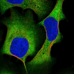 Invitrogen AKAP10 Polyclonal Antibody 100 &mu;L; Unconjugated:Antibodies,