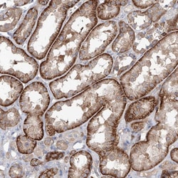 Invitrogen AKAP10 Polyclonal Antibody 100 &mu;L; Unconjugated:Antibodies,