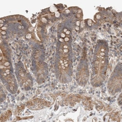 Invitrogen SLC6A7 Polyclonal Antibody 100 &mu;L; Unconjugated:Antibodies,