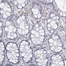 Invitrogen Centrin 2 Polyclonal Antibody 100 &mu;L; Unconjugated:Antibodies,