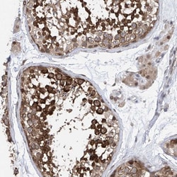 Invitrogen Centrin 2 Polyclonal Antibody 100 &mu;L; Unconjugated:Antibodies,