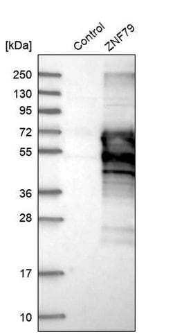 Invitrogen ZNF79 Polyclonal Antibody 100 &mu;L | Buy Online | Invitrogen&trade; | Fisher Scientific