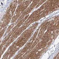 Invitrogen ZNF180 Polyclonal Antibody 100 &mu;L; Unconjugated:Antibodies,