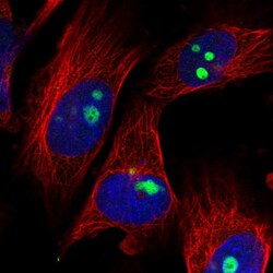 Invitrogen ZNF519 Polyclonal Antibody 100 μL; Unconjugated:Antibodies,