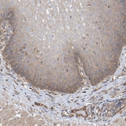 Invitrogen PHACTR4 Polyclonal Antibody 100 &mu;L; Unconjugated:Antibodies,