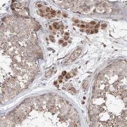 Invitrogen&trade;&nbsp;SAMD3 Polyclonal Antibody