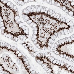 Invitrogen SRSF6 Polyclonal Antibody 100 &mu;L; Unconjugated:Antibodies,