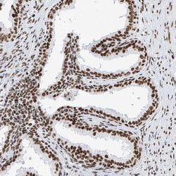 Invitrogen SRSF6 Polyclonal Antibody 100 &mu;L; Unconjugated:Antibodies,